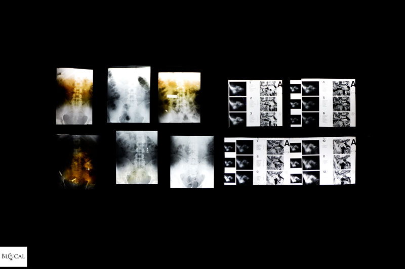 museum dr guislain ghent 